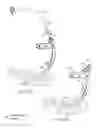 Fig. 33 - Method and apparatus for minimally invasive posterolateral spinal fusion