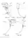 Fig. 34 - Method and apparatus for minimally invasive posterolateral spinal fusion