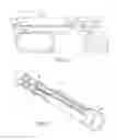 Fig. 02 - Two-stage electrosurgical device for vessel sealing