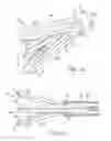 Fig. 07 - Two-stage electrosurgical device for vessel sealing