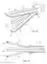 Fig. 07 - Two-stage electrosurgical device for vessel sealing