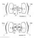 Fig. 09 - Renal neuromodulation for treatment of human patients