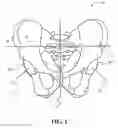 Fig. 02 - System and method for surgical planning