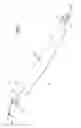 Fig. 02 - Method of treating urinary incontinence by anchoring a support to periosteum tissue