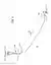 Fig. 06 - Method of treating urinary incontinence by anchoring a support to periosteum tissue