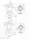 Fig. 08 - Method of treating urinary incontinence by anchoring a support to periosteum tissue