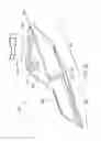 Fig. 35 - Method of treating urinary incontinence by anchoring a support to periosteum tissue