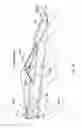 Fig. 40 - Method of treating urinary incontinence by anchoring a support to periosteum tissue