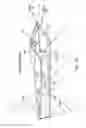Fig. 41 - Method of treating urinary incontinence by anchoring a support to periosteum tissue