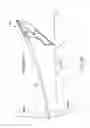 Fig. 43 - Method of treating urinary incontinence by anchoring a support to periosteum tissue