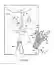 Fig. 46 - Method of treating urinary incontinence by anchoring a support to periosteum tissue