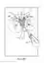 Fig. 48 - Method of treating urinary incontinence by anchoring a support to periosteum tissue
