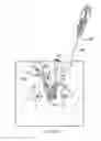 Fig. 50 - Method of treating urinary incontinence by anchoring a support to periosteum tissue