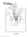 Fig. 52 - Method of treating urinary incontinence by anchoring a support to periosteum tissue