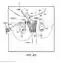 Fig. 53 - Method of treating urinary incontinence by anchoring a support to periosteum tissue