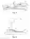 Fig. 06 - Implantable prosthesis for soft tissue repair