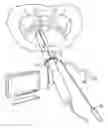 Fig. 01 - System and method for pelvic floor repair