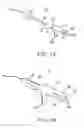 Fig. 02 - System and method for pelvic floor repair