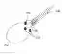 Fig. 01 - Gallbladder implant and systems and methods for the delivery thereof
