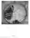 Fig. 06 - Gallbladder implant and systems and methods for the delivery thereof