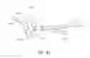 Fig. 71 - MINIMALLY INVASIVE TISSUE SUPPORT