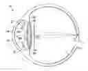 Fig. 01 - DUAL REGION ACCOMMODATING INTRAOCULAR LENS DEVICES, SYSTEMS, AND METHODS