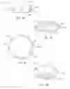Fig. 09 - Prosthetic capsular devices, systems, and methods