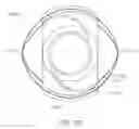 Fig. 35 - Prosthetic capsular devices, systems, and methods