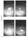 Fig. 79 - Prosthetic capsular devices, systems, and methods
