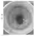 Fig. 80 - Prosthetic capsular devices, systems, and methods