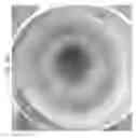 Fig. 85 - Prosthetic capsular devices, systems, and methods