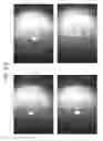 Fig. 87 - Prosthetic capsular devices, systems, and methods