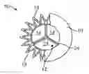 Fig. 01 - Transcatheter mitral valve prosthesis