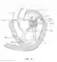 Fig. 03 - Transcatheter mitral valve prosthesis