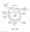 Fig. 08 - Transcatheter mitral valve prosthesis
