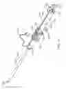 Fig. 23 - Transcatheter mitral valve prosthesis