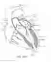 Fig. 30 - Transcatheter mitral valve prosthesis
