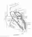 Fig. 34 - Transcatheter mitral valve prosthesis