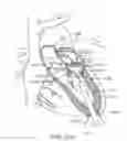 Fig. 35 - Transcatheter mitral valve prosthesis