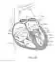 Fig. 41 - Transcatheter mitral valve prosthesis