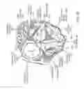 Fig. 44 - Transcatheter mitral valve prosthesis