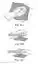 Fig. 16 - Cardiac support device delivery tool with release mechanism