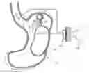 Fig. 01 - Implantable medical device for lubricating an artificial contacting surface