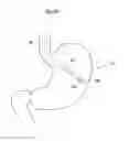 Fig. 09 - Implantable medical device for lubricating an artificial contacting surface