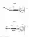 Fig. 12 - Implantable medical device for lubricating an artificial contacting surface