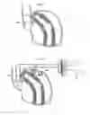 Fig. 17 - Implantable medical device for lubricating an artificial contacting surface