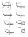 Fig. 23 - Implantable medical device for lubricating an artificial contacting surface