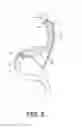 Fig. 05 - Gastrointestinal bypass devices and related methods of use