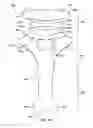 Fig. 19 - SPINAL SUPPORT DEVICE