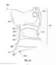 Fig. 26 - SPINAL SUPPORT DEVICE